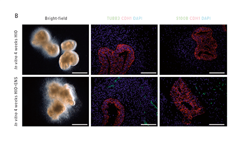 Figure B depicts immunofluorescence analysis of organoids generated in vitro with (HIO+ENS) and without (HIO) NCC addition. Left, bright-field images. Middle, immunostaining for neurons and epithelium. Right, immunostaining for glial cells and epithelium.